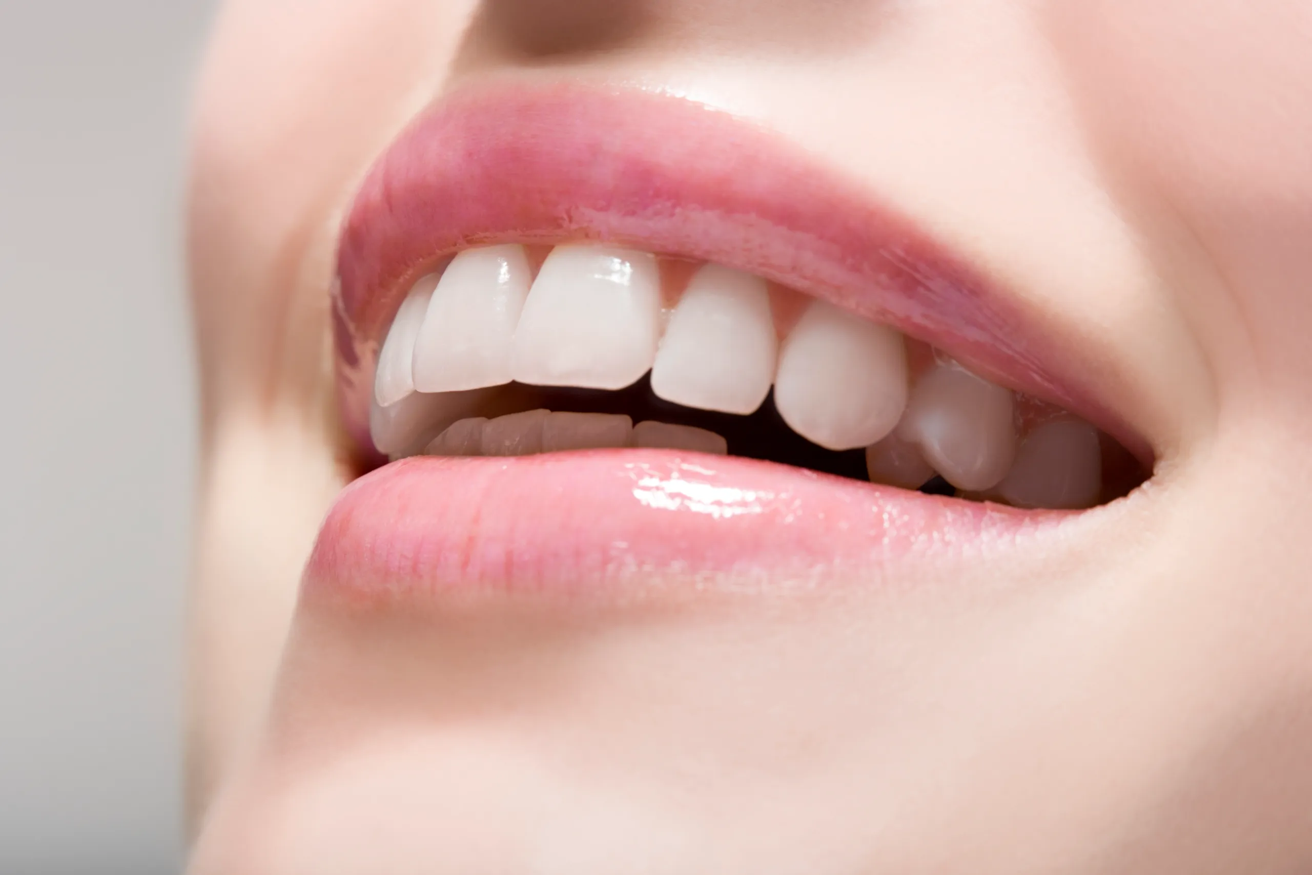 1 Hour Laser Teeth Whitening FAQs Telford