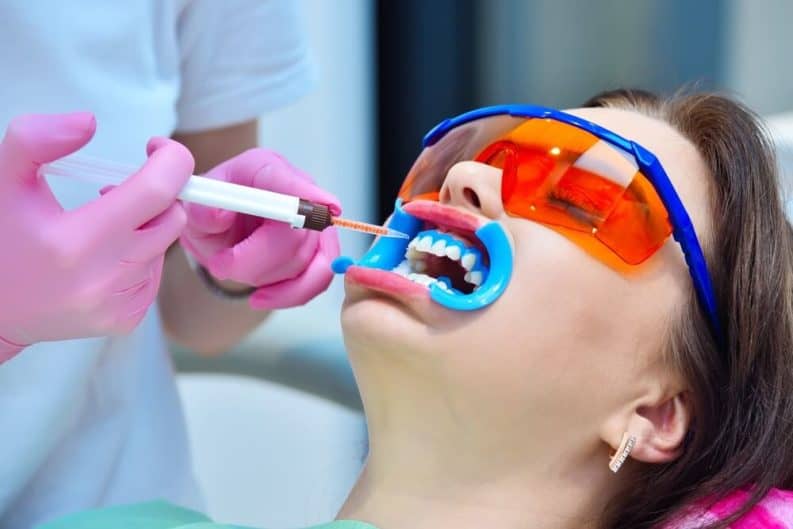 Get a brighter smile in minutes with instant results whitening Telford
