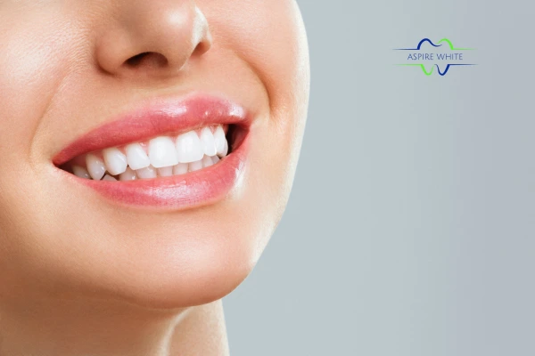 Safe and effective laser whitening treatment for visibly whiter teeth Telford