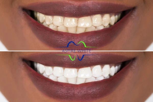 Side-by-side comparison showing before and after results of a cosmetic treatment Telford