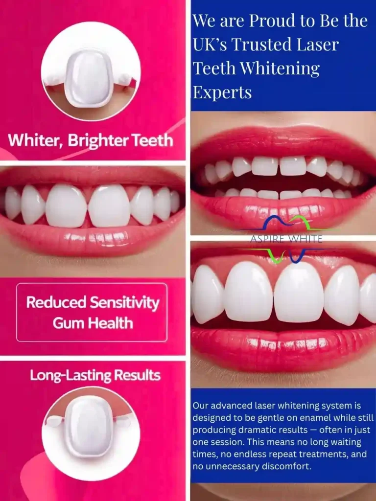 We are Proud to Be the UK’s Trusted Laser Teeth Whitening Experts Telford