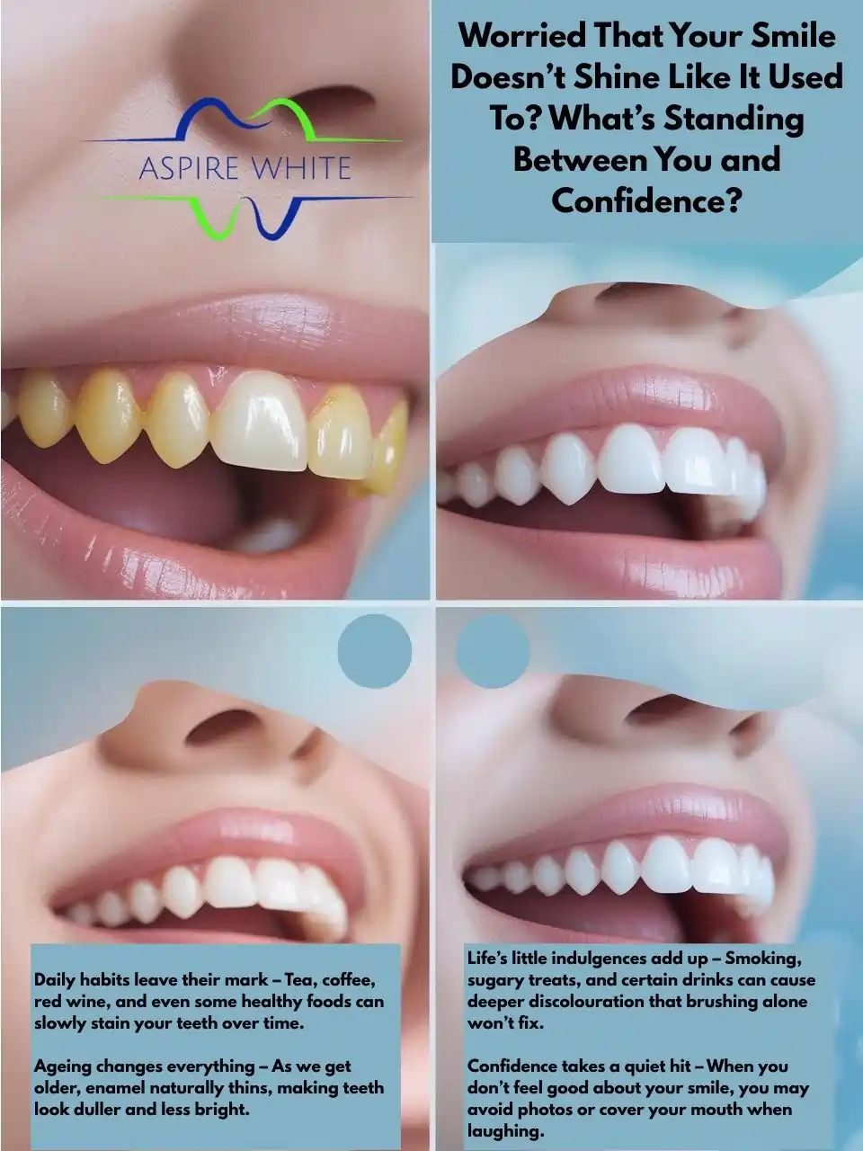 Worried That Your Smile Doesn’t Shine Like It Used To What’s Standing Between You and Confidence Telford